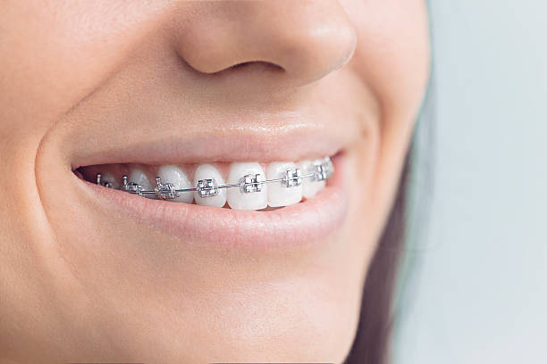 Best Traditional Braces  in St Martinville, LA